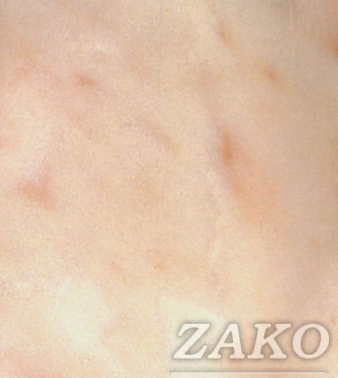 Marmur 1, jasny